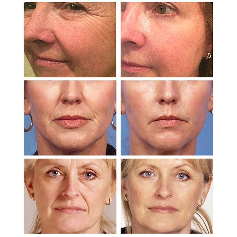 Retinol Lifting Firming Anti-aging Face Cream